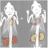 Positron Emission Tomography (PET)